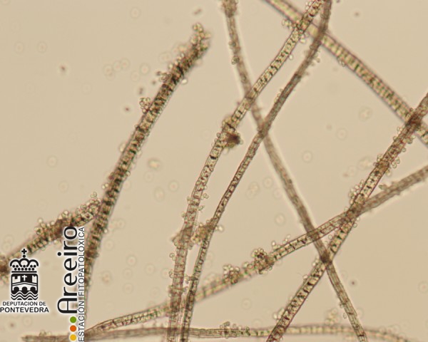 Graphiola phoenicis - Esporas y filamentos de Graphiola phoenicis.jpg